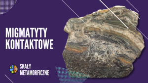 MIGMATYTY KONTAKTOWE